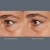 Dermalogica Awaken Peptide Eye Gel 15ml